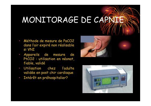 detresse respiratoire aigue et ventilation non ... - SMUR BMPM