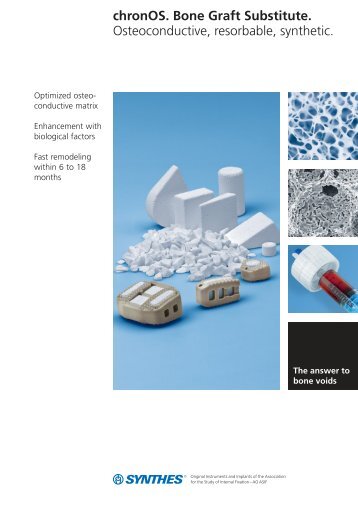 chronOS. Bone Graft Substitute. Osteoconductive ... - Osteosyntese