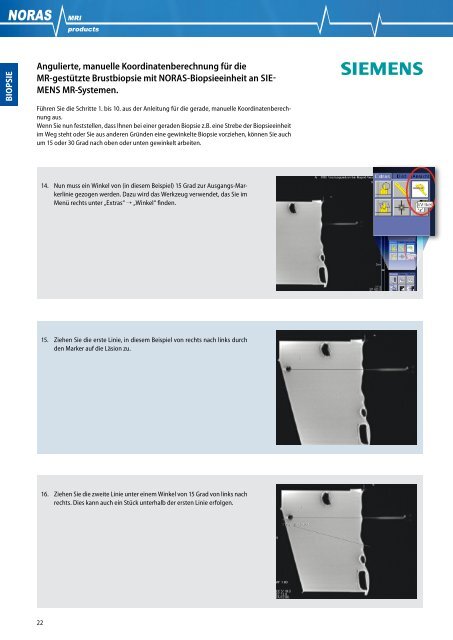 NORAS Prospekt SIEMENS 2012 EN - NORAS MRI products GmbH