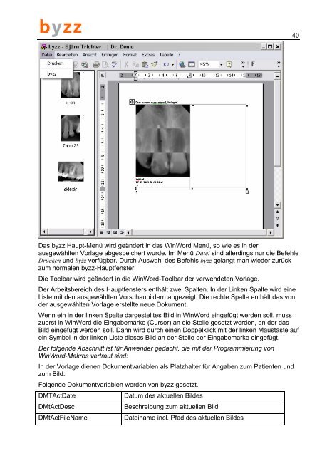 pdf-Datei [5MB] - up to dent