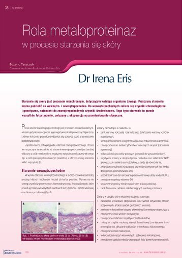 Rola metaloproteinaz - Dr Irena Eris