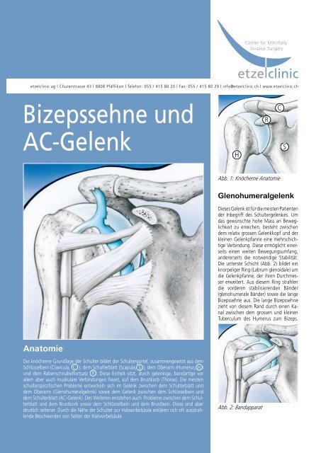 Bizepssehne und AC-Gelenk - in der etzelclinic