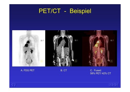 Molekulare Bildgebung mit PET (H. Harke)