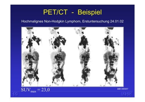 Molekulare Bildgebung mit PET (H. Harke)