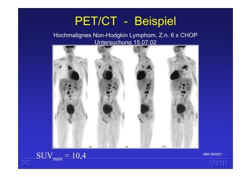 Molekulare Bildgebung mit PET (H. Harke)