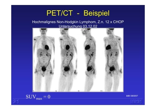 Molekulare Bildgebung mit PET (H. Harke)