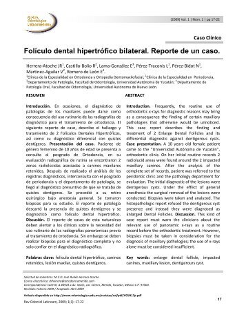 FolÃ­culo dental hipertrÃ³fico bilateral. Reporte de un caso.