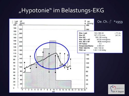 Hypotonie - Vereinigung Zuercher Internisten