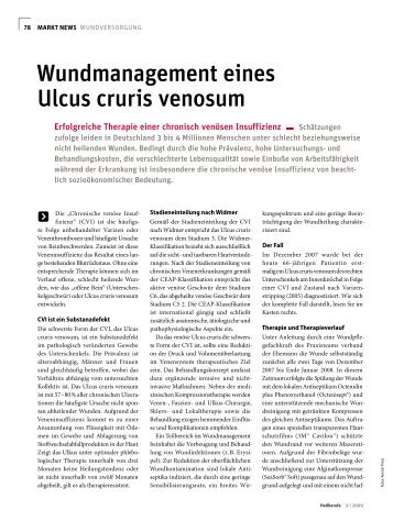 Wundmanagement eines Ulcus cruris venosum - Werner Sellmer