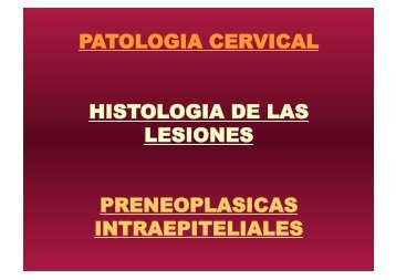 patologia cervical histologia de las lesiones preneoplasicas ... - IGBA