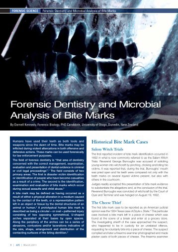 Forensic Dentistry and Microbial Analysis of Bite Marks (PDF 398KB)