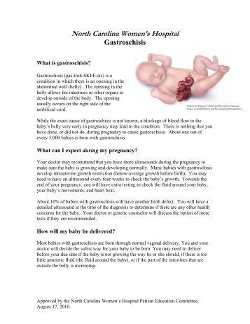 Gastroschisis