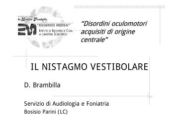 IL NISTAGMO VESTIBOLARE