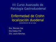 Enfermedad de Crohn localización duodenal - Dra. Marcela ... - caded