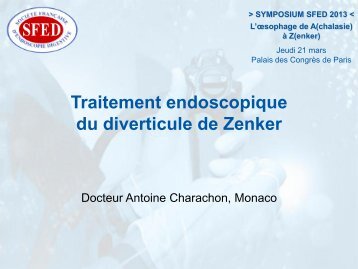 Traitement endoscopique du diverticule de Zenker - SFED