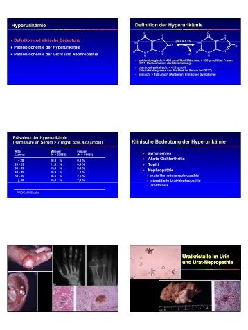 Hyperurikämie Definition der Hyperurikämie Klinische Bedeutung ...