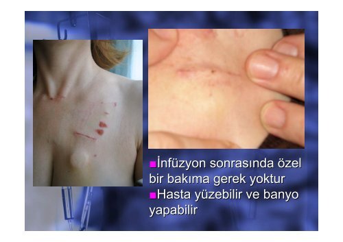 Antineoplastik Ä°laÃ§ HazÄ±rlama Merkezinde