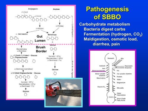 Small Bowel Bacterial Overgrowth