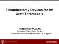 Thrombectomy Devices for AV Graft Thrombosis