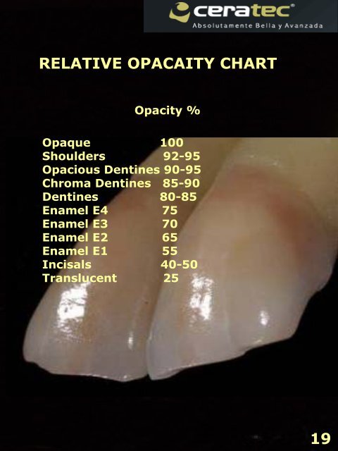 ceratec's porcelain system