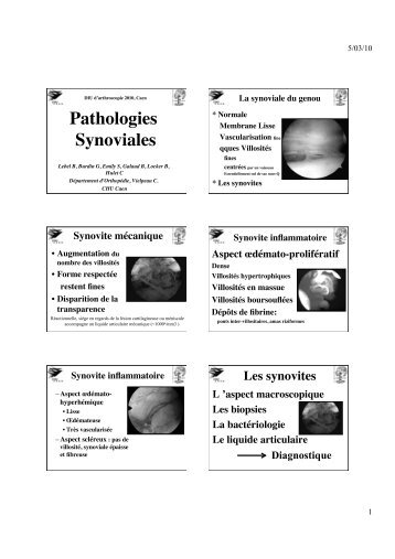 Pathologies Synoviales