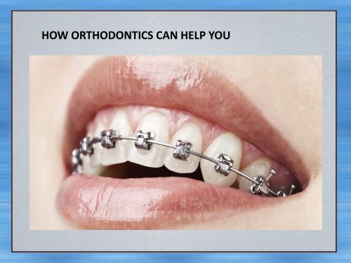 Why you need a Rancho Penasquitos Orthodontist?