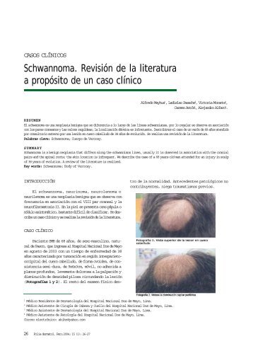 Schwannoma. RevisiÃ³n de la literatura a propÃ³sito de un caso clÃ­nico