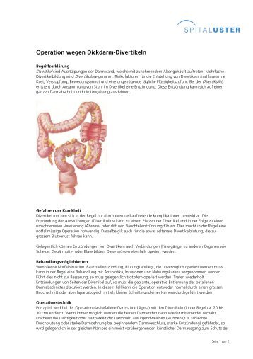 Operation wegen Dickdarm-Divertikeln - Spital Uster