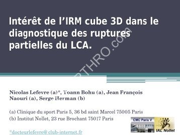 Intérêt de l'IRM cube 3D dans le diagnostique des ruptures partielles ...