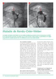 Maladie de Rendu-Osler-Weber (135Kb) - CHUV