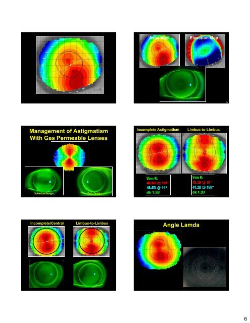 The Fundamentals of GP Lenses Design and Fitting Disclosures GP ...