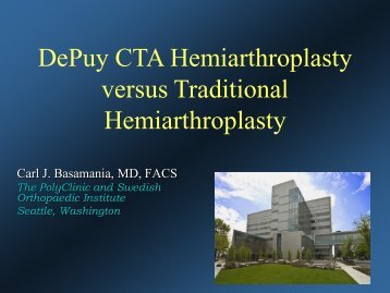 DePuy CTA Hemiarthroplasty versus Traditional Hemiarthroplasty