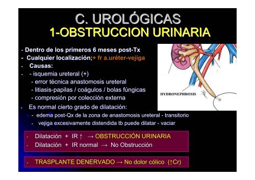 causas del uréter doble causas del uréter doble