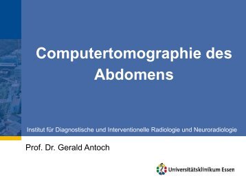 Computertomographie des Abdomens