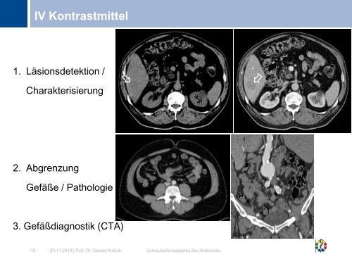 Computertomographie des Abdomens