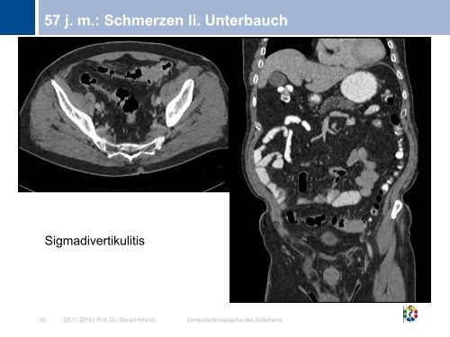 Computertomographie des Abdomens