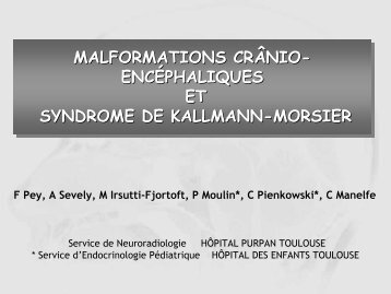 malformations crÃ¢nio- encÃ©phaliques et syndrome de kallmann ...