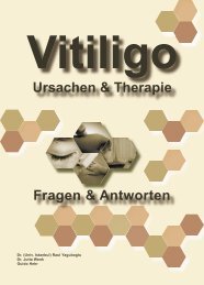 Vitiligo - Hautsache