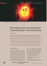 Photodynamische antimikrobielle Chemotherapie in der ... - Cumdente