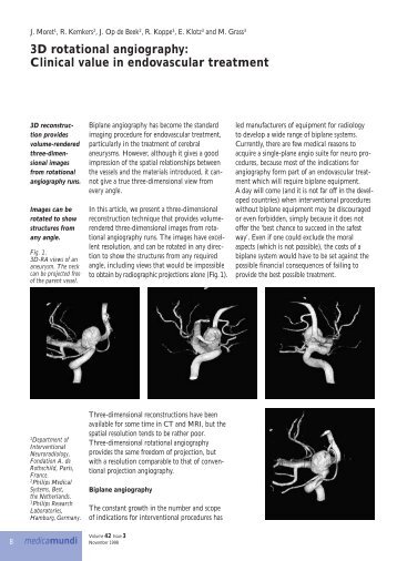 3D rotational angiography: Clinical value in ... - Philips Healthcare