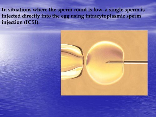 In vitro fertilisation supervised by Dr.Ali Alhussaini Dr. Sausan Talib