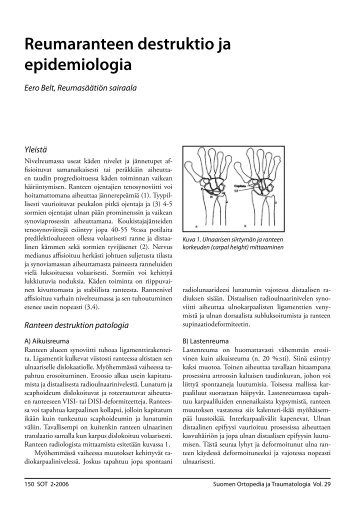 Reumaranteen destruktio ja epidemiologia