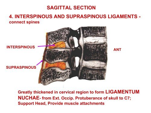 IMAGING OF VERTEBRAE