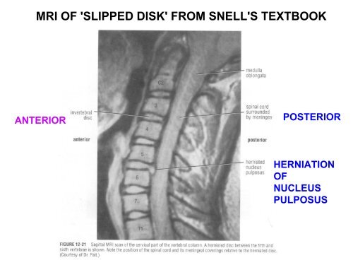 IMAGING OF VERTEBRAE