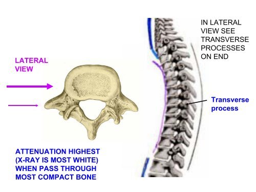 IMAGING OF VERTEBRAE