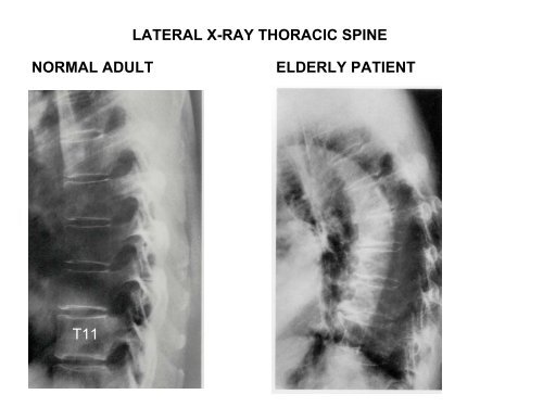 IMAGING OF VERTEBRAE