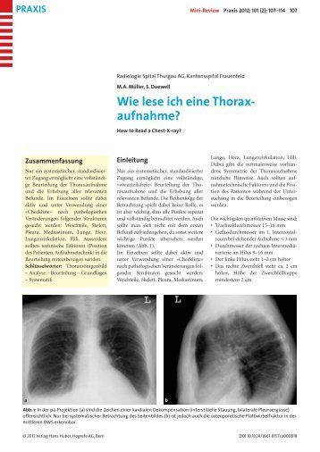 Wie lese ich eine Thorax- aufnahme?