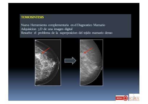 Imagenologia Mamaria - IGBA