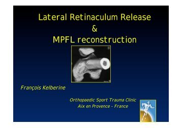 Lateral Retinaculum Release & MPFL reconstruction