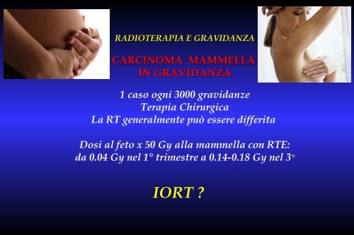 RADIOTERAPIA E GRAVIDANZA PROBLEMI DA AFFRONTARE